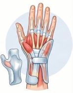 Curso Actualización en rehabilitación de muñeca-mano y prescripción/confección de órtesis 